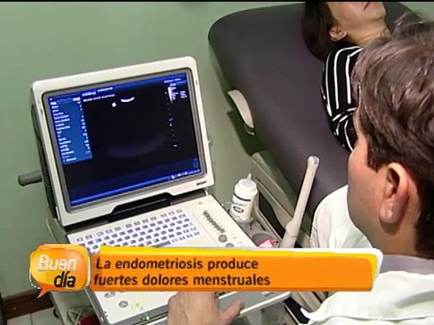 Endometriosis afecta aproximadamente a una de cada diez mujeres