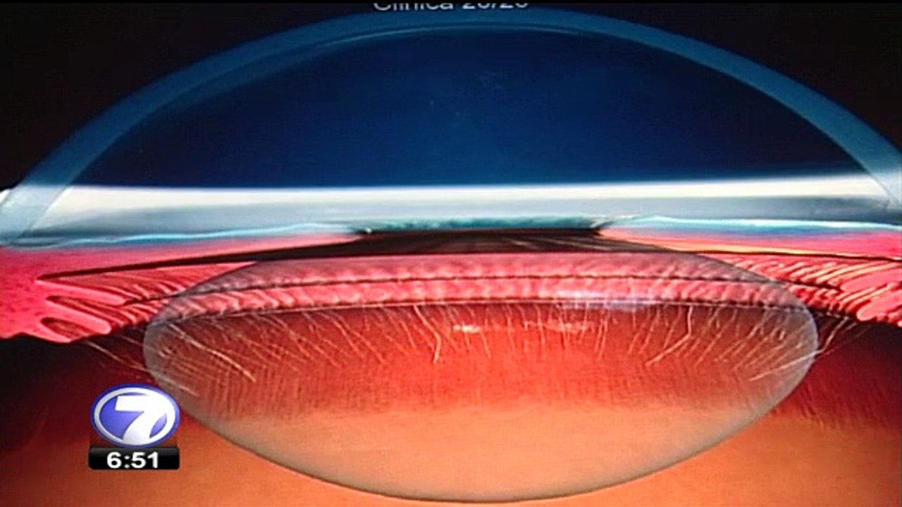 Varios problemas de salud pueden diagnosticarse mediante los ojos