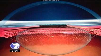Varios problemas de salud pueden diagnosticarse mediante los ojos