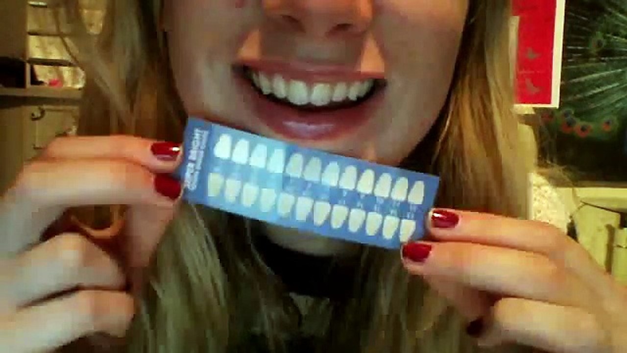 sbiancamento denti