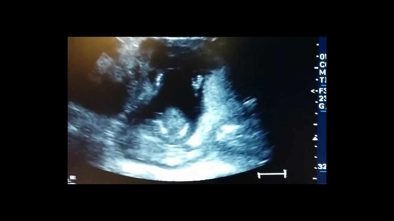 Clap your hands, baby announcement.