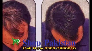 Hair Building Fiber oil in Pakistan | Hair Building Fiber in ShopPakistan.com.pk