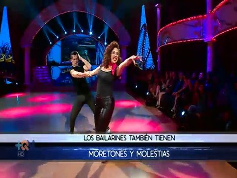 Las estrellas se enfrentan a varios moretones y lesiones a lo largo de la gala de DWTS