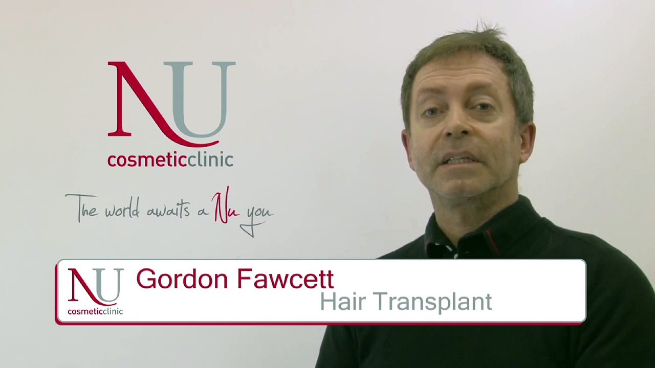 Hair Transplant Surgery UK - An Out-Of-The-Blue ‘Miracle’ For Gordon Fawcett