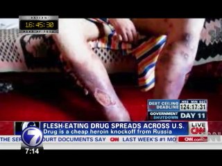 Una nueva y agresiva droga causa estragos en Rusia y Estados Unidos