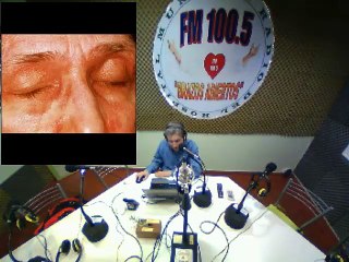 Radio Brazos Abiertos Hospital Muñiz Programa CULTURA Y SALUD 1 DE ABRIL DE 2015