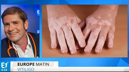 Le vitiligo, qu'est-ce que c'est ?