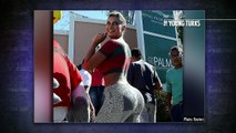 Plastic Surgery Goes Horribly Wrong For Miss BumBum [Graphic]