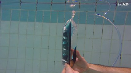 S09E03 - Manoeuvre de Valsalva