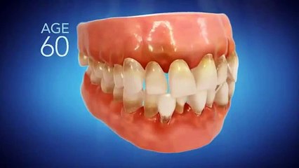 Invisalign Dentist Columbia MD - Call (410) 964-2422