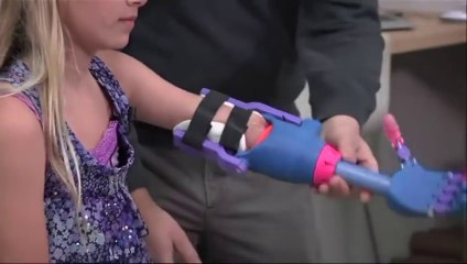 7-year-old Girl Gets 3-D Printed Robohand, a pink and purple girly arm!