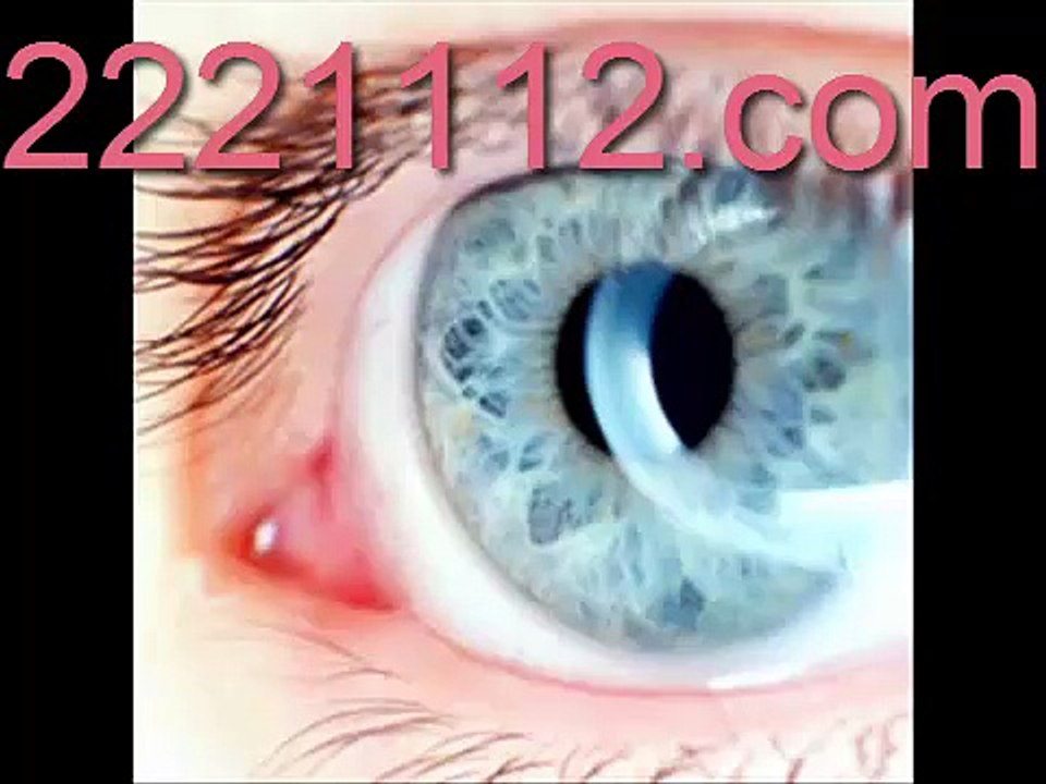Eyes - laser -  اردو