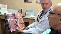 Dental Implant Reconstruction - Hartford, CT - Dr. Balloch
