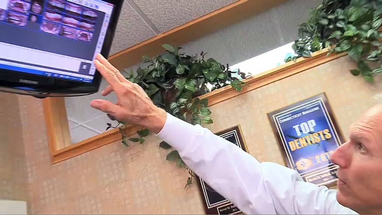 Dental Patient Testimonial - Hartford, CT - Dr. Steven Balloch