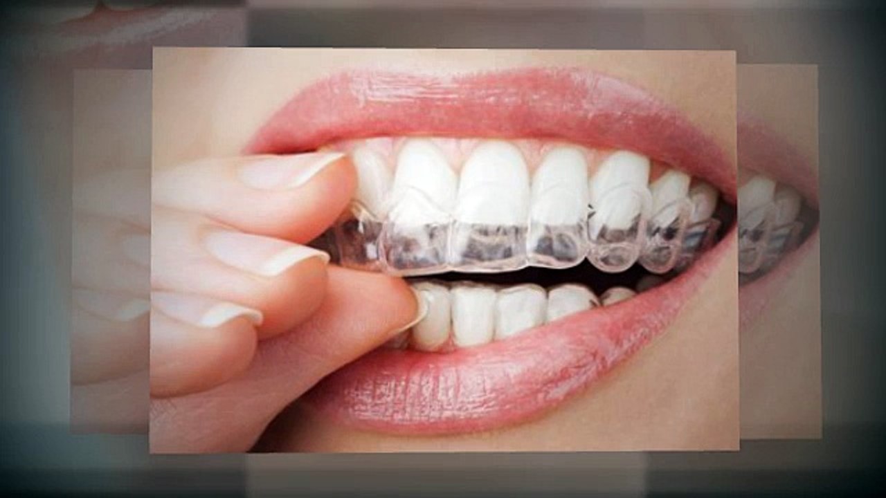 Bella Labs Teeth Whitening System