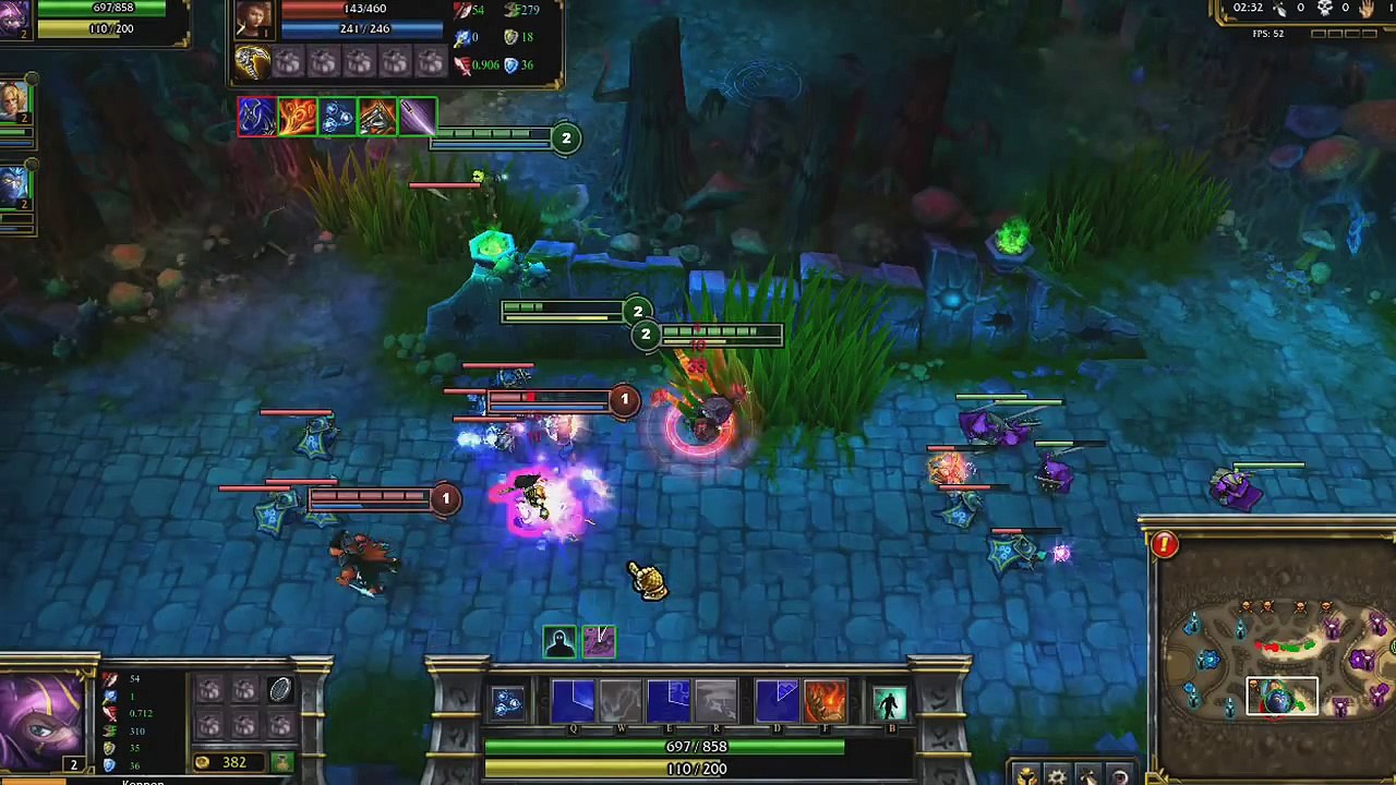 Kennen Champion Spotlight