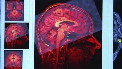 Muzyczny Umysl PL Dokument