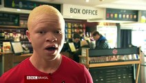 'Caçados como animais': Na Tanzânia, pessoas com albinismo vivem sob ameaça constante