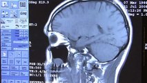 Imagerie médicale et médecine nucléaire : Tout savoir sur l'IRM
