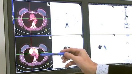 Pet Scan : Tout savoir sur cette technique de pointe