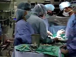 Live Webcast: Mitral Valve Repair Surgery