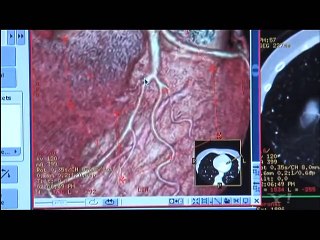 دل کا حملہ: علامات اور بچاؤ کے آسان طریقے 💓