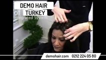 Protez Saç Firmaları ile ilgili şikayetler - Saç Ekimi Forum saç protez yenı bayan video