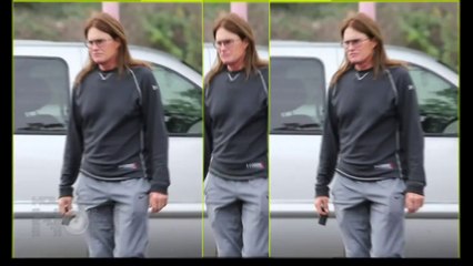 Bruce Jenner-BOOB-JOB Done 2015