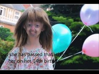 hayley okines 2012.wmv