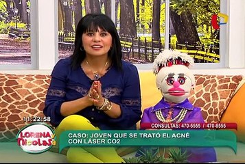 Láser CO2: el tratamiento efectivo contra el acné