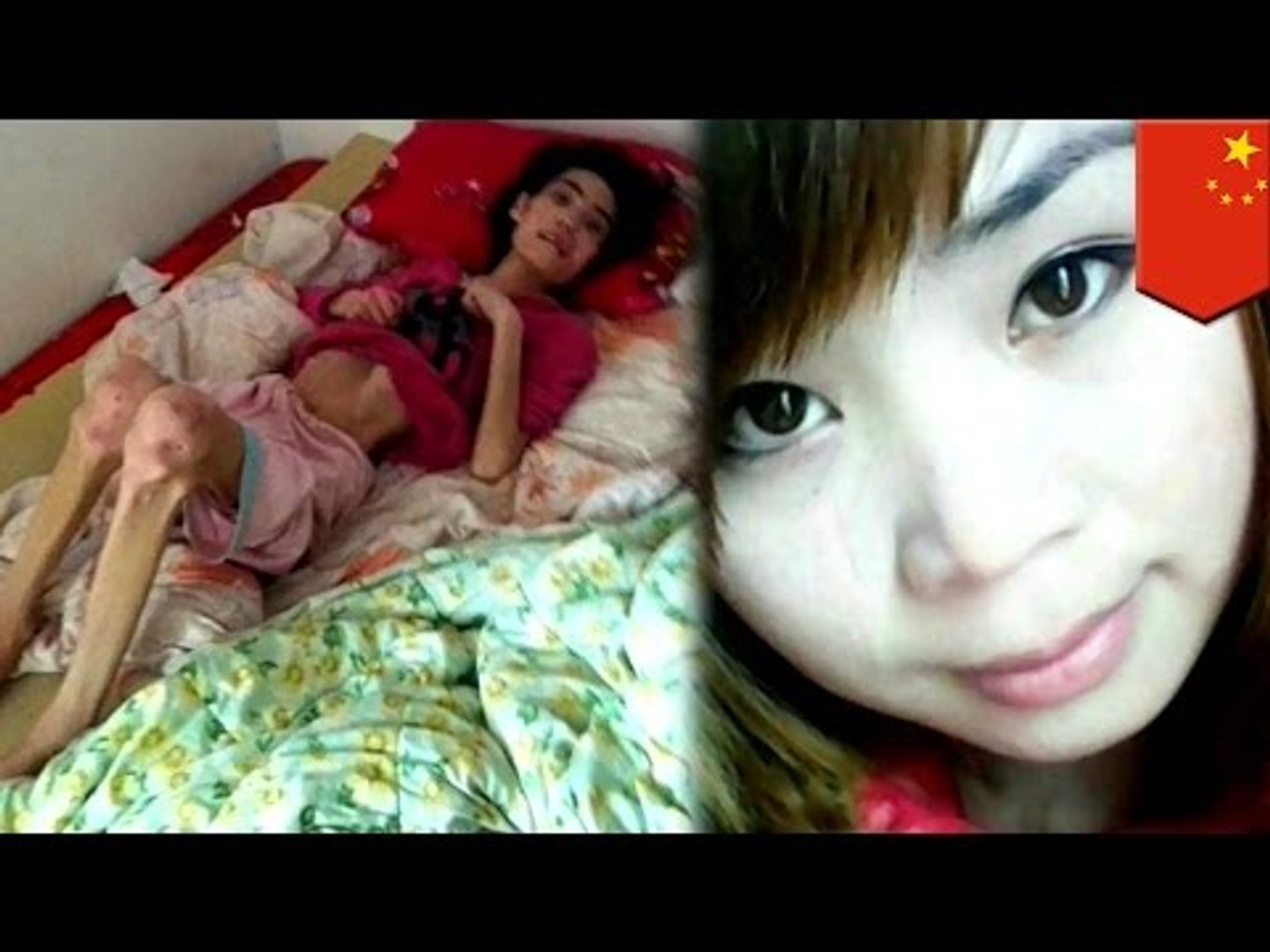 Свекровь  довела невестку до голодной смерти за жалобы на любовницу мужа