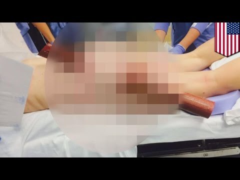 Женщину пригвоздило к водительскому креслу в результате отправки сообщений во время вождения