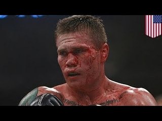 Джо Риггс прострелил себе руку и ногу, решив почистить заряженный пистолет