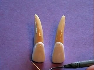 Maxillary Lateral Incisor Anatomy