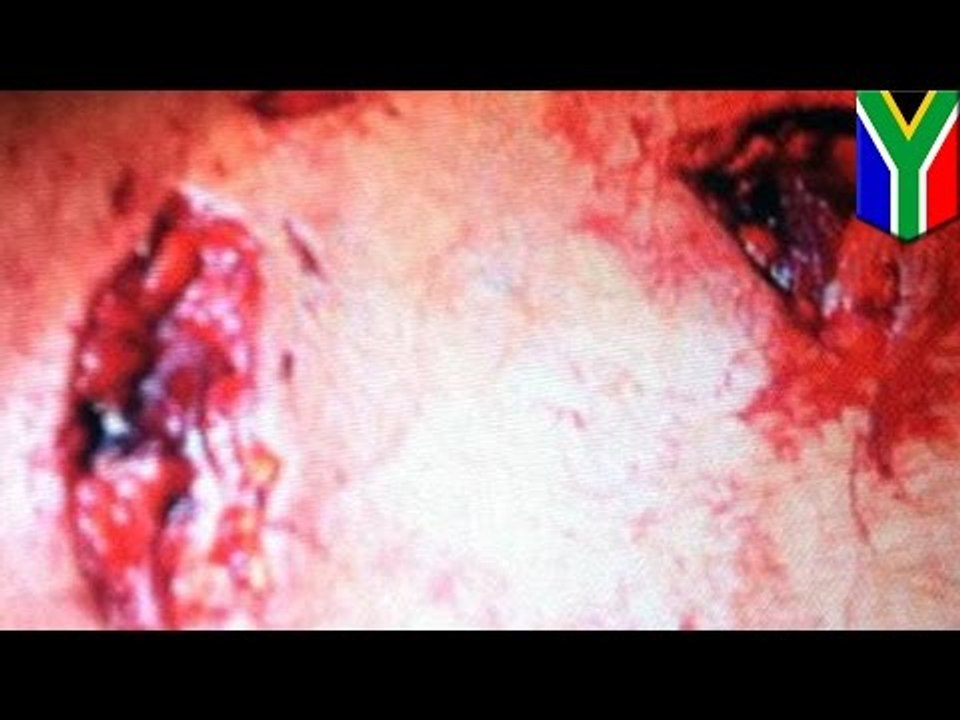 Leona ataca a turista australiano que estaba de safari en Sudáfrica