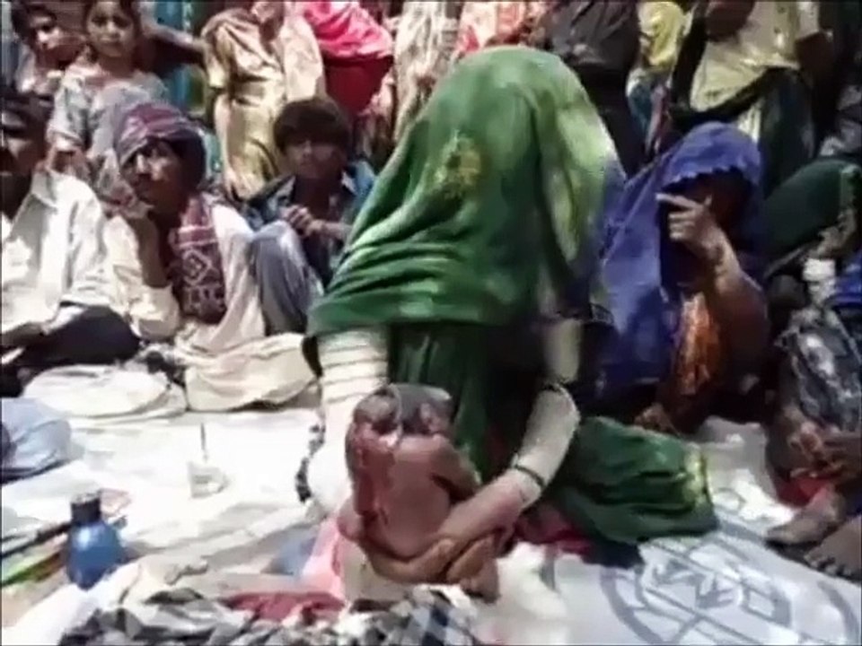 OMG!!! Abnormal Baby Born without BRAIN