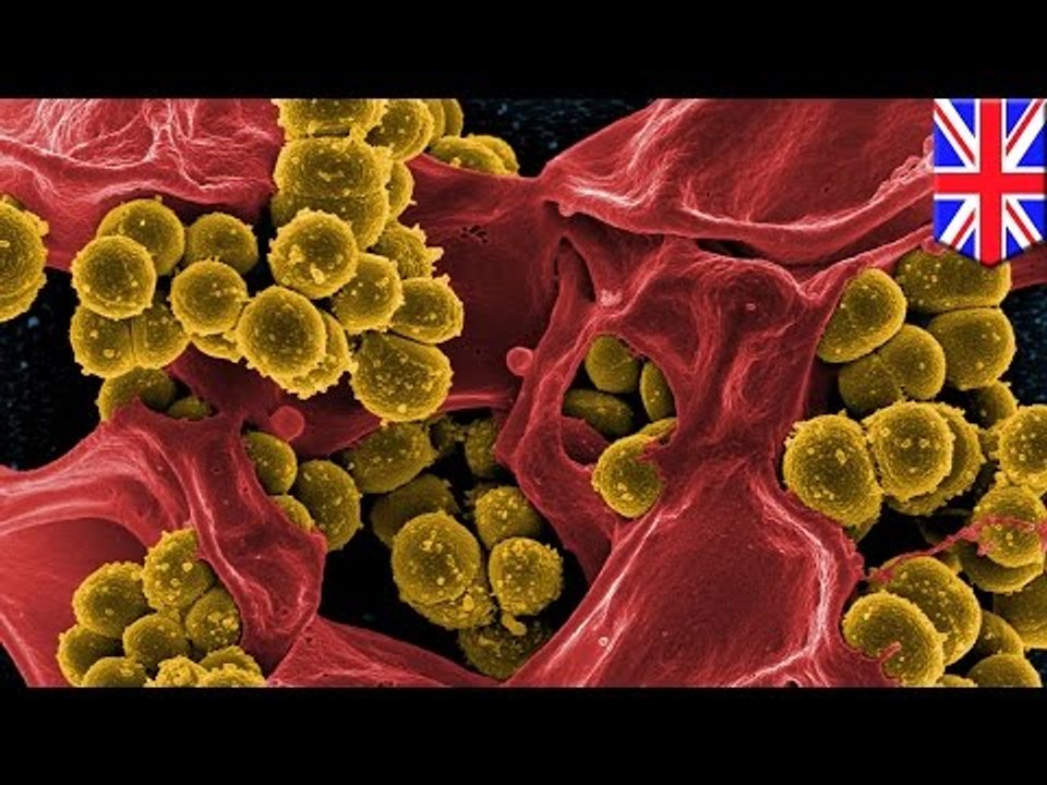 The end of superbugs? Medieval remedy kills up to 90 percent of MRSA bacteria in test
