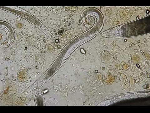 Entomopathogenic nematodes 1.avi