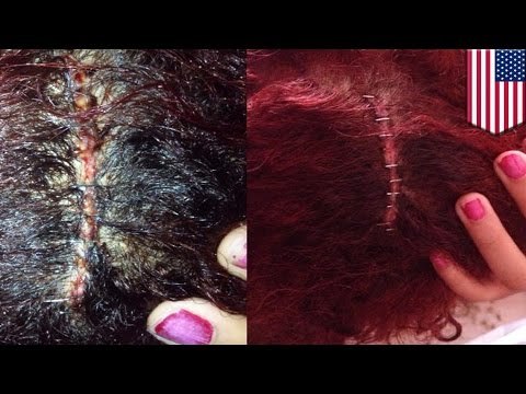 Skater punk fight: teen girl gets skull cracked open by skateboarders at Venice Beach park