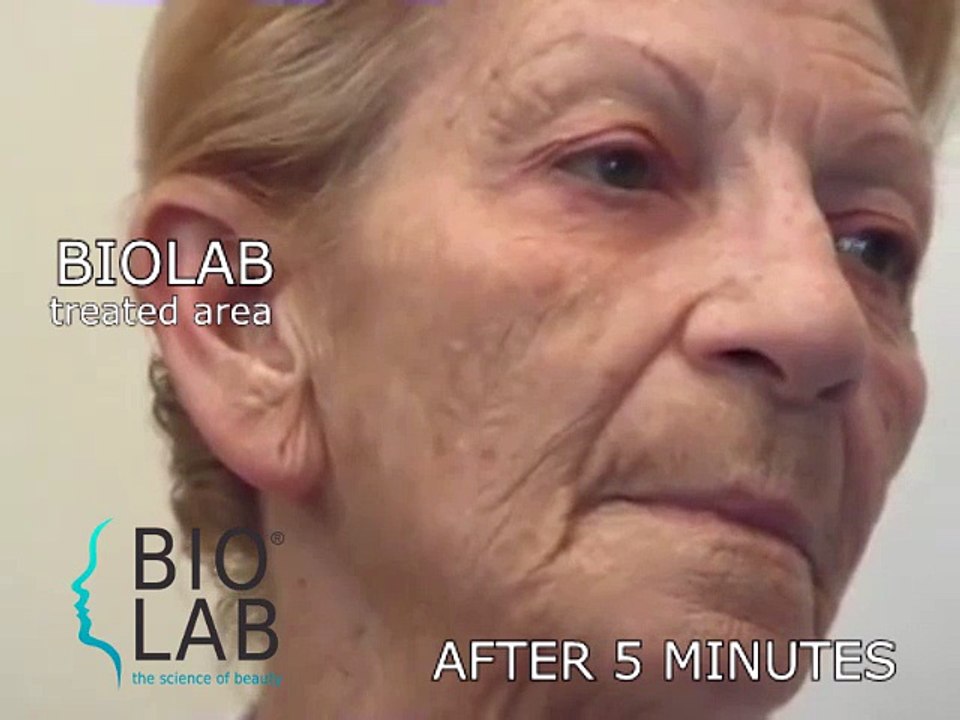 BIOLAB anti-aging mask