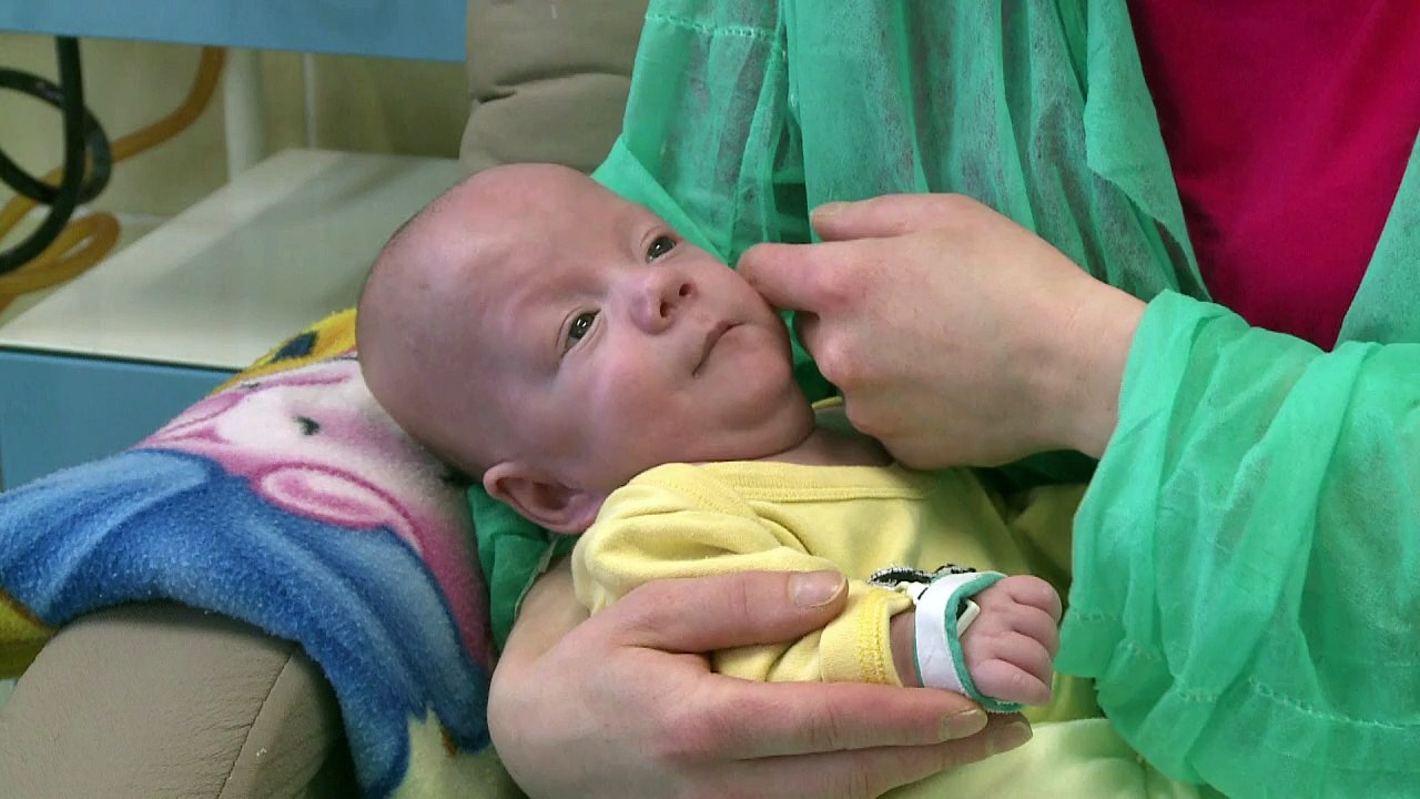 Un bébé prématuré extrême sauvé grâce à un rein artificiel