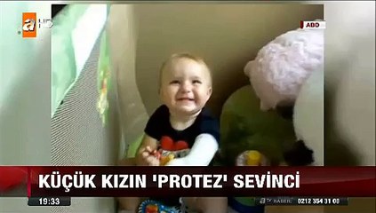 Küçük kıza 3 boyutlu yazıcıdan maliyeti 50 dolara çıkan Protez kol yaptılar