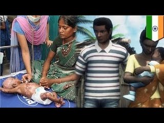 Родители в Индии уверяют, что их дети самовозгораются