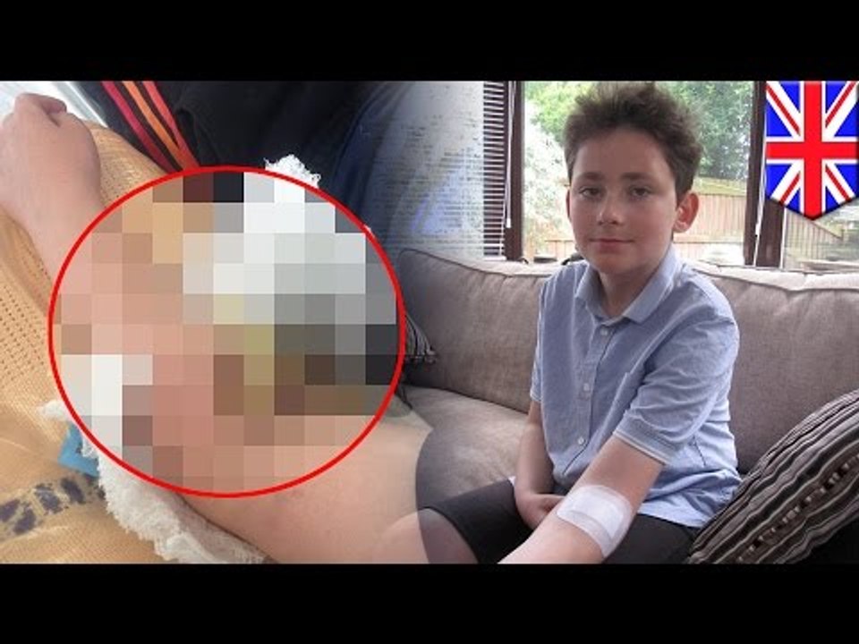 Junge an Türgriff aufgespießt