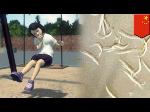 Niña con la costumbre de comerse las uñas estaba infectada con millones de gusanos