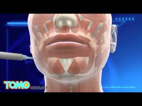 Mujer que viajo a Corea del Sur para realizarse cirugía plástica termina con sus labios inservibles