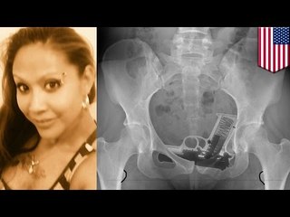 Женщина пронесла оружие в тюрьму…угадайте в каком месте!