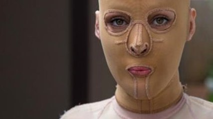 Kıskanç Kadın, Eşiyle Konuşan Kadının Yüzünü İspirto Döküp Yakmış!