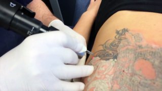 Pain-Free Florida Tattoo Removal Now Available From TattooRemovalVero_com