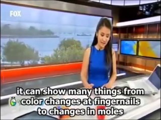 Forenscope by Grimed - FOX TV